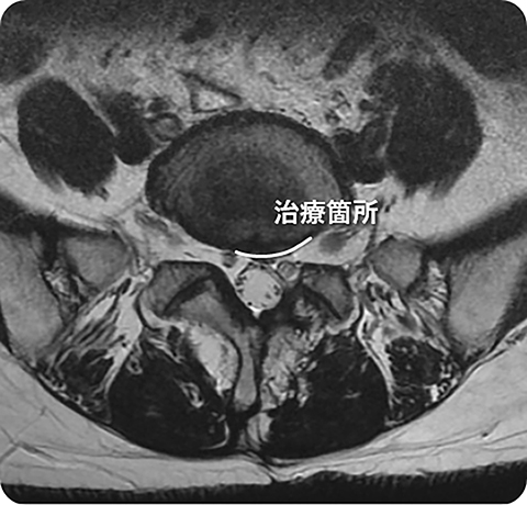 手術後